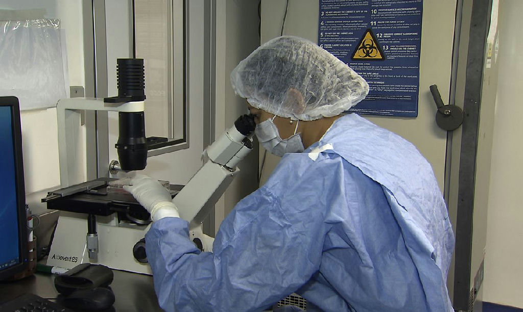 Avanços na ciência: novos casos de remissão do HIV após transplante de células-tronco