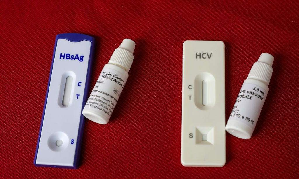 Julho Amarelo reforça importância do diagnóstico precoce das hepatites virais