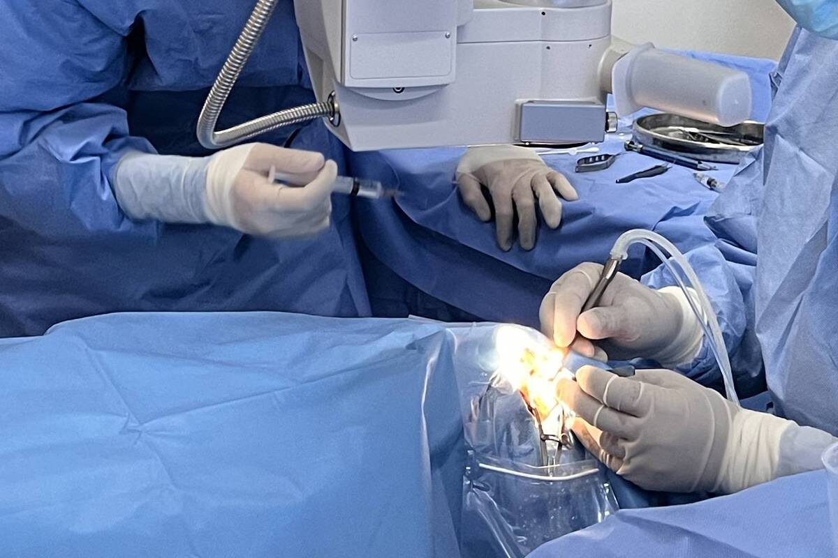 Como a ciência avalia as técnicas disponíveis e opções de lentes para tratar catarata