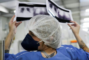 Diagnóstico avançado em 90% dos casos de câncer de pulmão no SUS reduz drasticamente a cura
