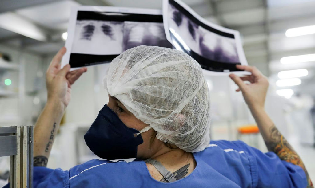Diagnóstico avançado em 90% dos casos de câncer de pulmão no SUS reduz drasticamente a cura