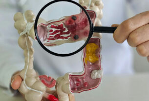 Doenças inflamatórias intestinais quintuplicam no Brasil em 13 anos