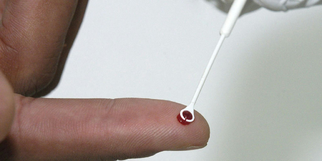 Fiji enfrenta emergência nacional por HIV com 1 a cada 60 habitantes infectados