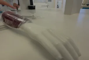 Pele de tilápia se torna curativo inovador para queimaduras e deve integrar o SUS