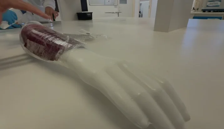 Pele de tilápia se torna curativo inovador para queimaduras e deve integrar o SUS