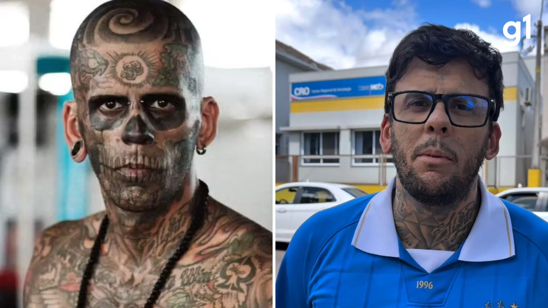 Após 1ª quimioterapia pelo SUS, homem mais tatuado do Brasil detalha tratamento contra câncer no Rio Grande do Sul