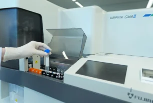 Brasil recebe novo exame de sangue para Alzheimer com detalhes sobre acesso e custos