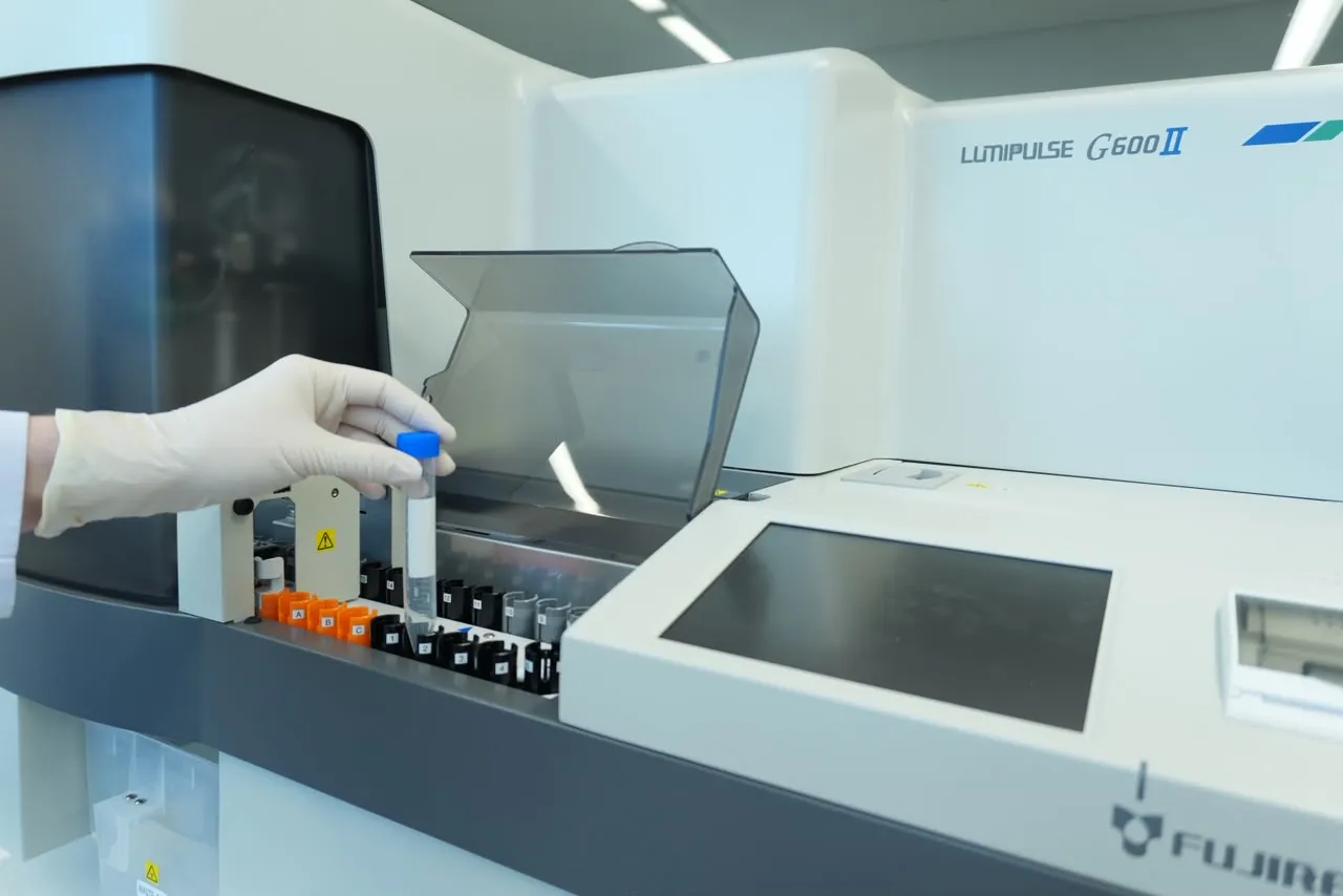 Brasil recebe novo exame de sangue para Alzheimer com detalhes sobre acesso e custos