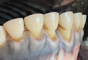 Entenda a anatomia dos bovinos e a ausência de dentes superiores