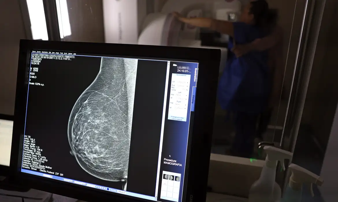 Entidades médicas criam manual contra recusa de mamografia digital por planos de saúde