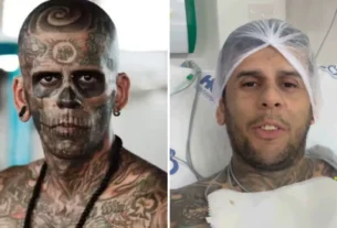 Homem mais tatuado do Brasil enfrenta câncer de bexiga invasivo e busca tratamento