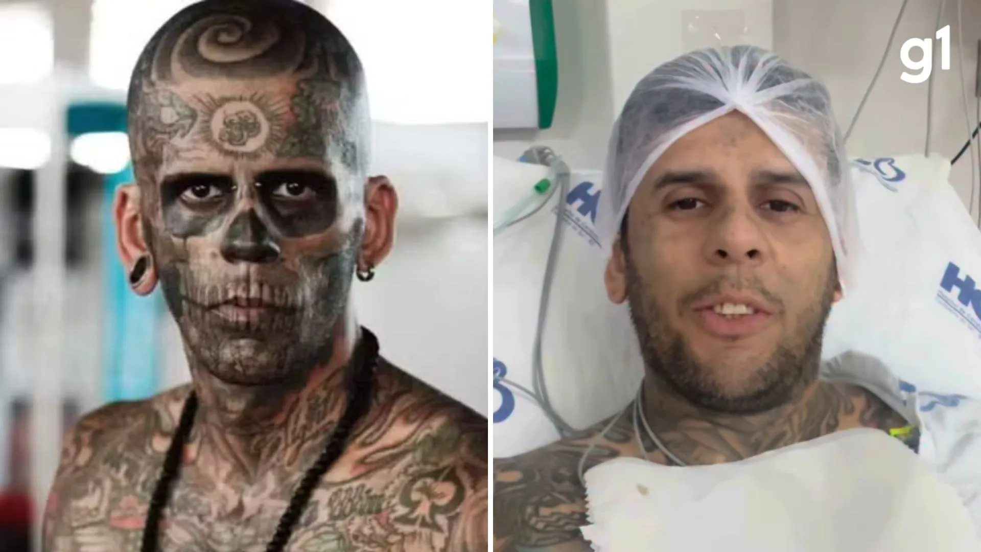 Homem mais tatuado do Brasil enfrenta câncer de bexiga invasivo e busca tratamento