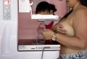 Hospital Nossa Senhora das Graças realiza mutirão de mamografias durante o Outubro Rosa