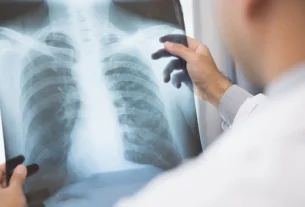 Medicamento contra câncer de pulmão avançado tem registro aprovado pela Anvisa